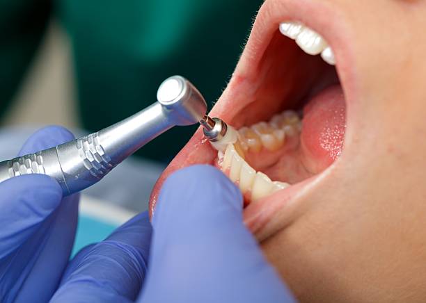 Best Wisdom Tooth Removal  in Assumption, IL